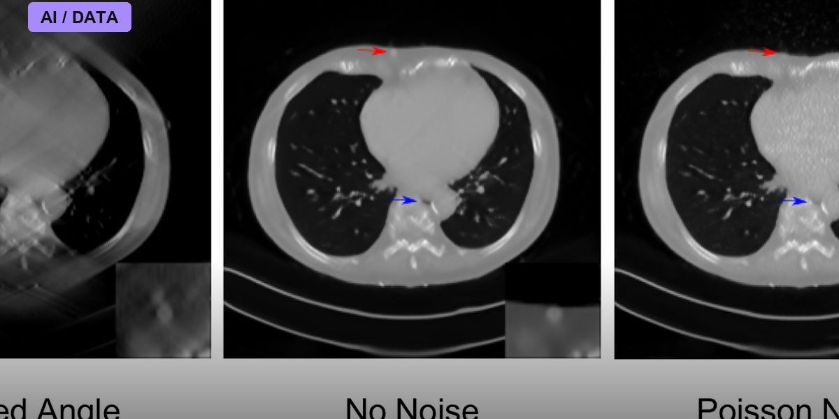 Deep Learning Reconstructs Images From Brain Activity