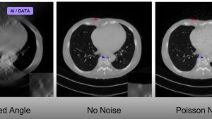 Deep Learning Reconstructs Images From Brain Activity