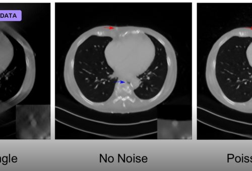 Deep Learning Reconstructs Images From Brain Activity