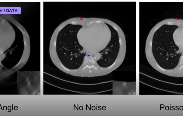 Deep Learning Reconstructs Images From Brain Activity