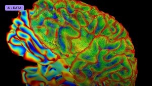 Whole-Brain Imaging Tracks Thought in a Living Animal
