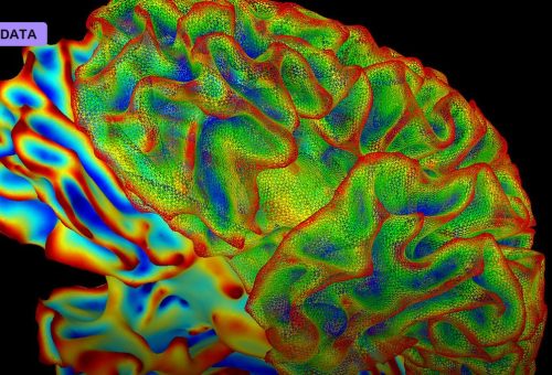 Whole-Brain Imaging Tracks Thought in a Living Animal