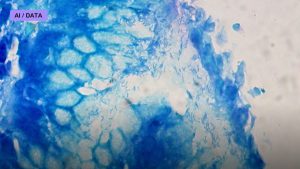 Liquid Biopsies Hunt Cancer in a Blood Draw