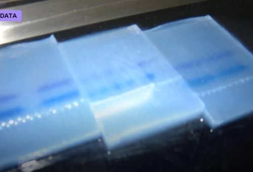 After Epic’s Sepsis Algorithm Flopped, Bayesian Health’s FDA-Cleared Rival Enters the Fight
