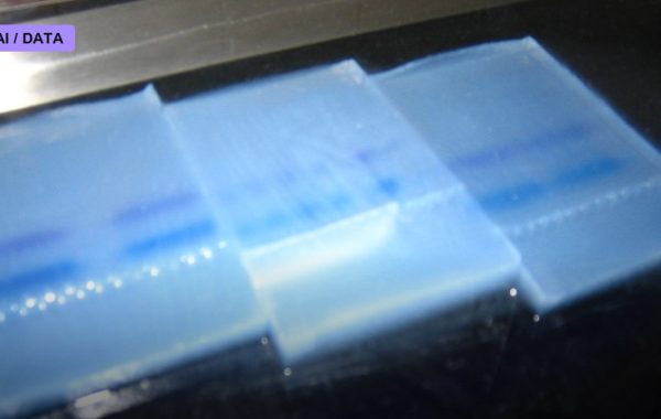 After Epic’s Sepsis Algorithm Flopped, Bayesian Health’s FDA-Cleared Rival Enters the Fight