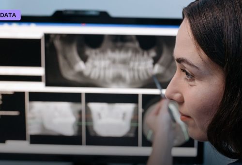 Nearly Half of US Dentists Now Use AI to Scan Your Teeth for Cavities You Can't See Yet