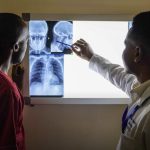 175,000-Woman NHS Study Finds AI Catches More Breast Cancers and Cuts Radiologists' Reading Time by a Third