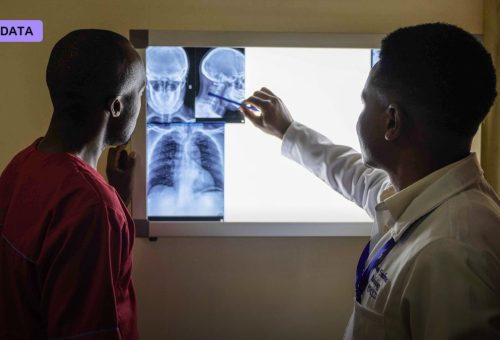 175,000-Woman NHS Study Finds AI Catches More Breast Cancers and Cuts Radiologists' Reading Time by a Third
