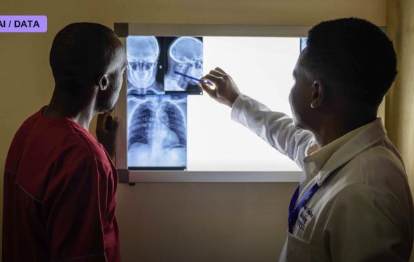 175,000-Woman NHS Study Finds AI Catches More Breast Cancers and Cuts Radiologists' Reading Time by a Third