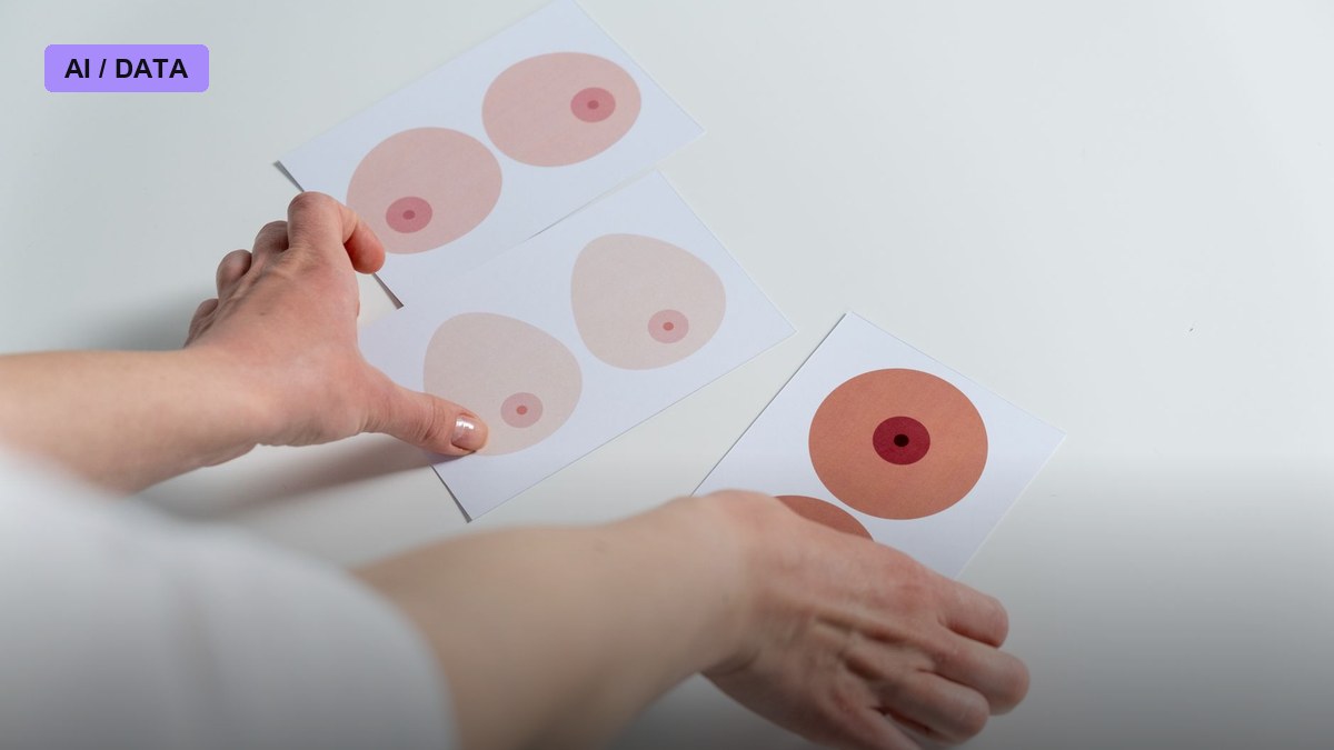 NYU Langone's New AI Tool Reads Years of Mammograms to Predict Who Actually Needs Extra Breast Cancer Screening