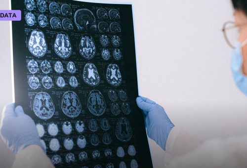 Cleveland Clinic Puts Siemens' AI Prostate MRI Tool Through a Clinical Trial Before Trusting It at the Bedside