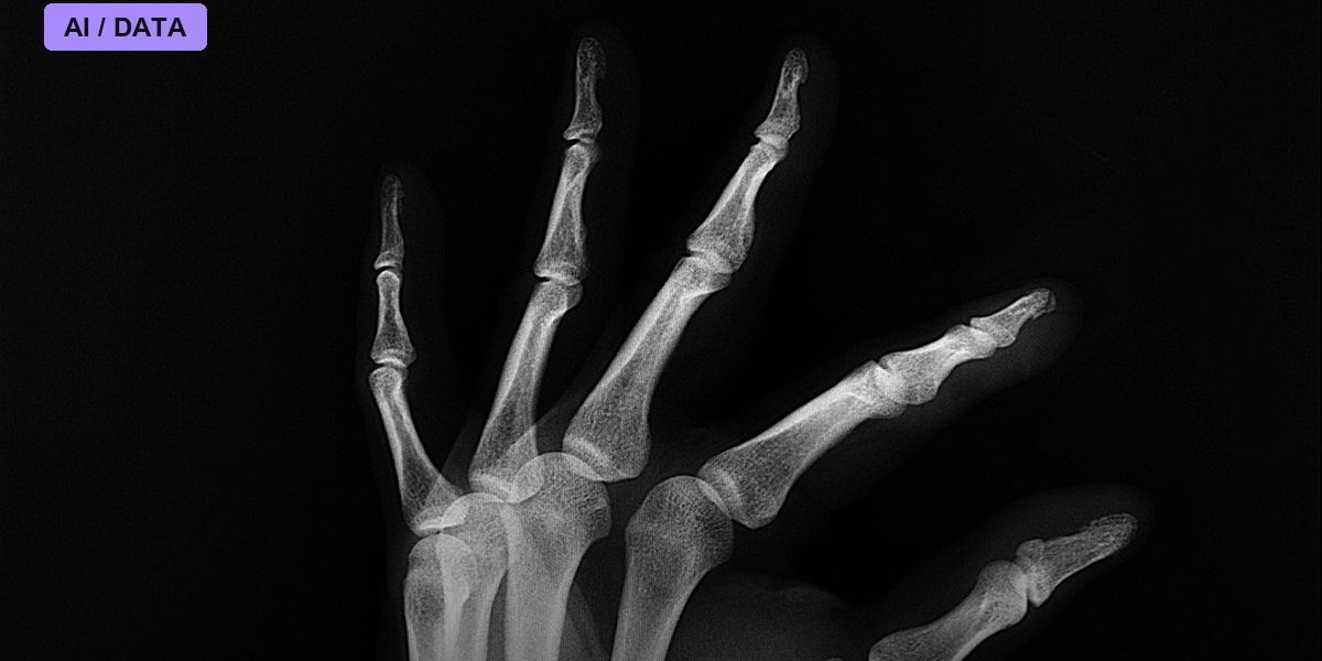 Records Reveal Medicare's AI Prior-Authorization Pilot Denied Over 20,000 Claims and Missed Its Own 72-Hour Rule