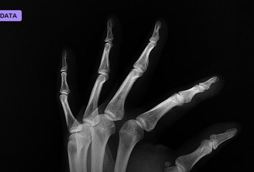 Records Reveal Medicare's AI Prior-Authorization Pilot Denied Over 20,000 Claims and Missed Its Own 72-Hour Rule