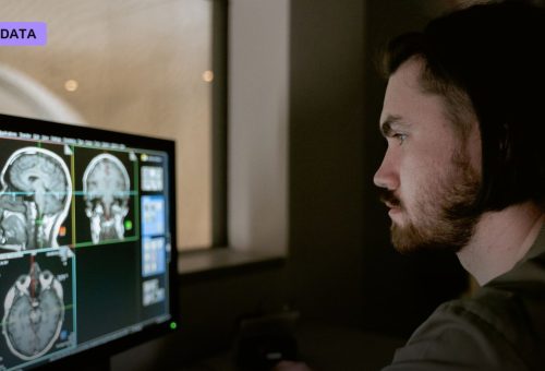 Google's Mammography AI Beats Human Readers in Largest NHS Breast Cancer Trial Yet