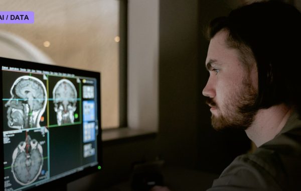 Google's Mammography AI Beats Human Readers in Largest NHS Breast Cancer Trial Yet