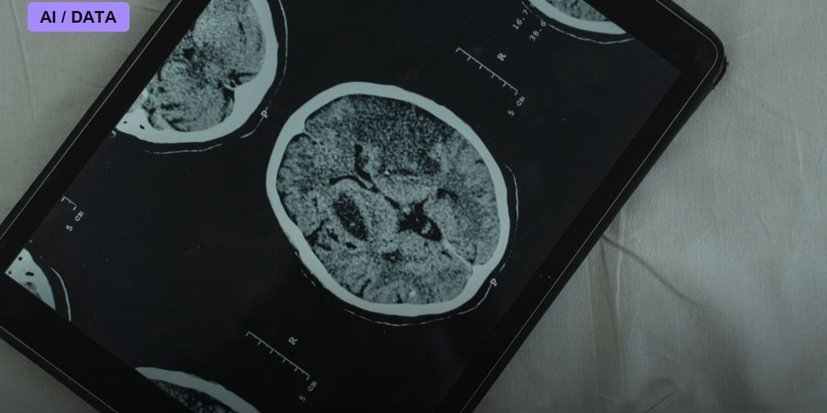 OSF HealthCare Expands AI-Powered Stroke Detection to Rural Illinois Hospitals