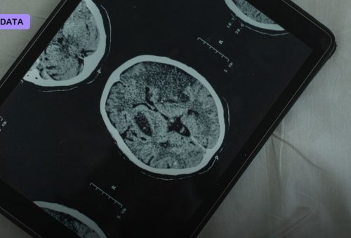 OSF HealthCare Expands AI-Powered Stroke Detection to Rural Illinois Hospitals