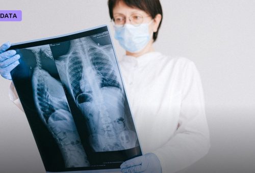 FDA Grants Breakthrough Status to AI That Drafts Radiology Reports Before Radiologists Even Log In