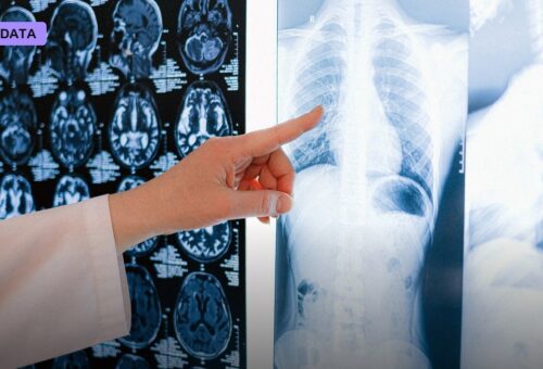 Quebec Startup Bia Health Raises $2.15 Million to Curb Unnecessary Medical Imaging With AI