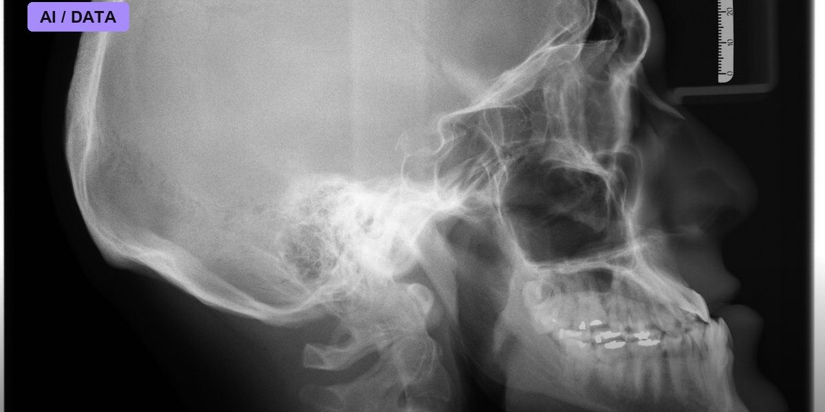 A Dallas Community Hospital Just Went Live With FDA-Cleared AI That Flags Brain Bleeds on CT Scans