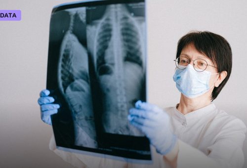An AI Looked at 420,000 Routine Chest X-Rays and Found a New Way to Predict Who Dies Early